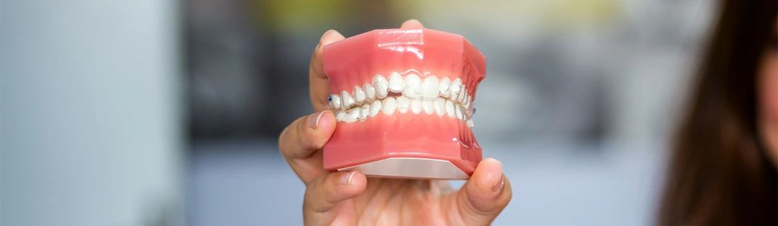 FC – Get Custom Dentures at Regala and Su, DDS in Aiea, HI FC – Get Custom Dentures at Regala and Su, DDS in Aiea, HI